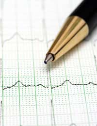 Electrocardiogram Ecg Chest Pain