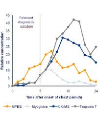 Cardiac Biomarkers Heart Heart Attack